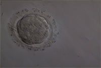 4. nap (hagyományos IVF-el megtermékenyült, kompakt morula)
