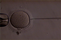 ICSI (Intracytoplasmic Sperm Injection), Beinjektálás folyamata képekben