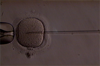 ICSI (Intracytoplasmic Sperm Injection), Beinjektálás folyamata képekben