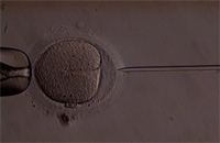ICSI (Intracytoplasmic Sperm Injection), Beinjektálás folyamata képekben